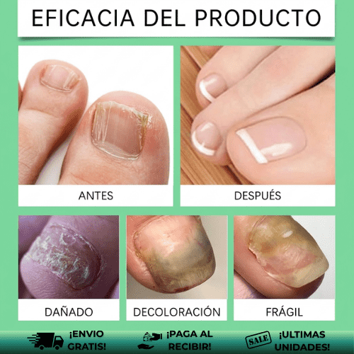 BeamBalm™ | Esmalte que transforma y protege tus uñas