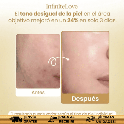 LUMIMASK™ | Mascarilla coreana nocturna para manchas, melasma y brillo Instantáneo