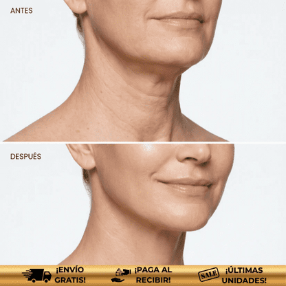 SeraVena™ | Spray de colágeno para firmeza total