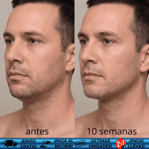 ContourUp™ ¡Oferta 2x1! + eBook Profesional | Banda moldeadora antipapada